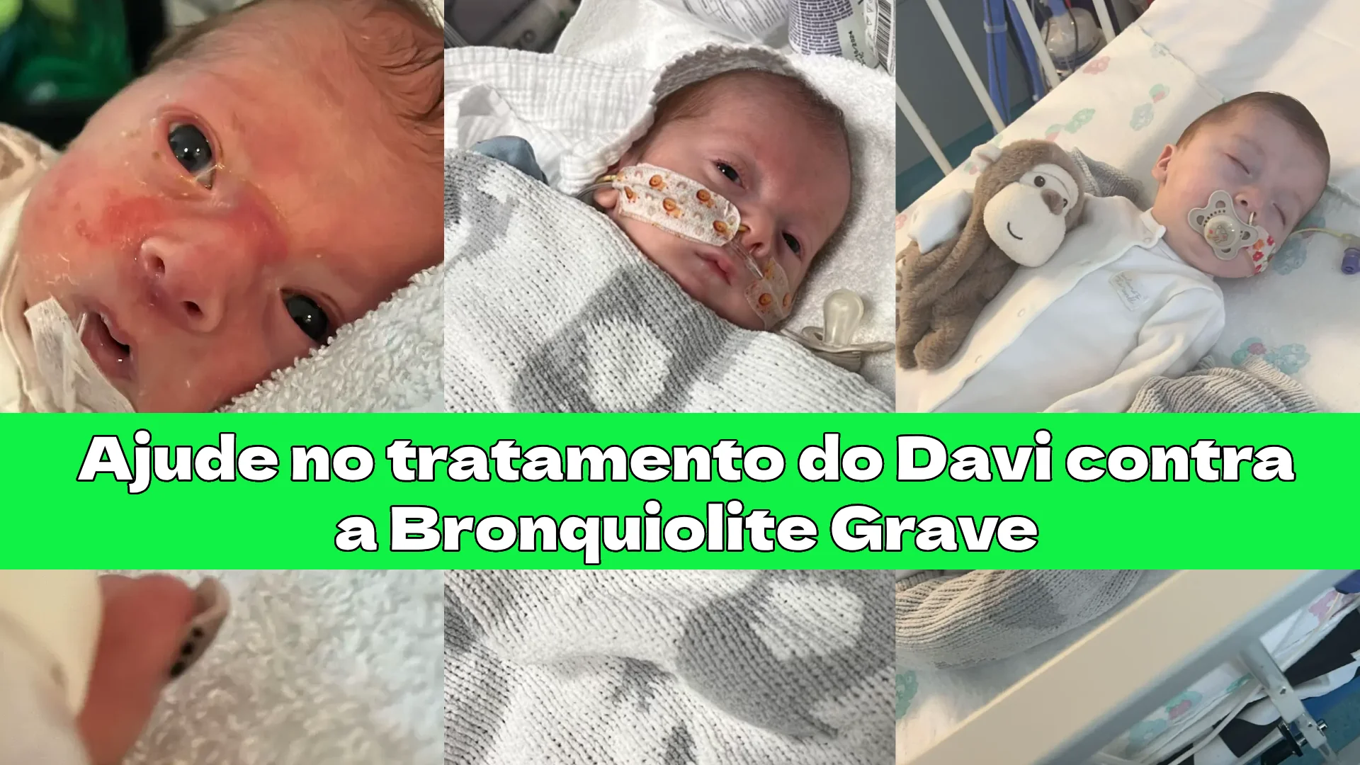 Bebê Davi de 1 ano internado no hospital com equipamentos respiratórios